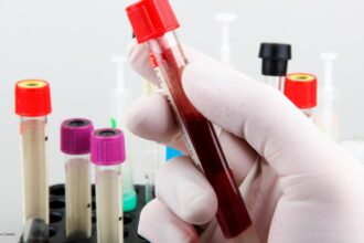 anvisa aprovou norma que permite a realização de exames de análise clínica em farmácias e consultórios