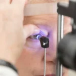 Glaucoma não tem cura, mas, com diagnóstico precoce, é possível conter o avanço da doença